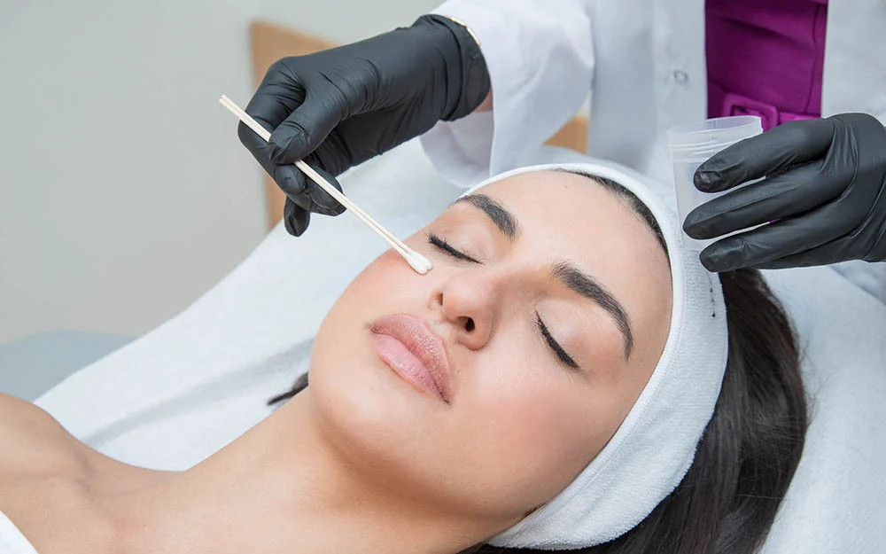 Chemical Peel Treatment in Dubai