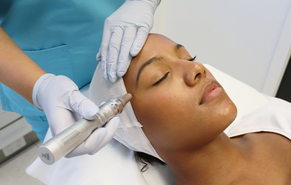 Microneedling Treatment Dubai