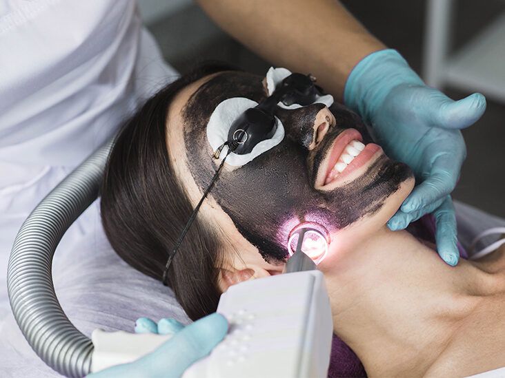 Laser carbon peel in Dubai